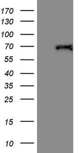 THRA Monoclonal Antibody (OTI6B7), TrueMAB , OriGene:Antibodies:Primary