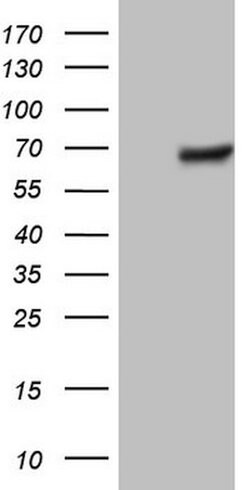 THRA Mouse anti-Human, Clone: OTI7G2, lyophilized, TrueMAB 100 &mu;g; Unconjugated:Antibodies,