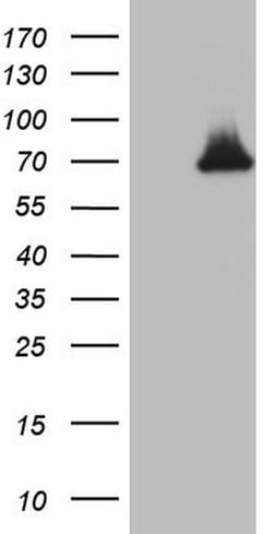 THRA Monoclonal Antibody (OTI5E12), TrueMAB , OriGene 100 &mu;L; Unconjugated:Anticuerpos