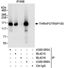 THRAP3/TRAP150 Rabbit anti-Human, Polyclonal, Bethyl Laboratories 100 &mu;L;