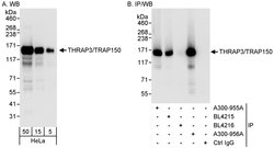 THRAP3/TRAP150 Rabbit anti-Human, Polyclonal, Bethyl Laboratories 100 &mu;L;