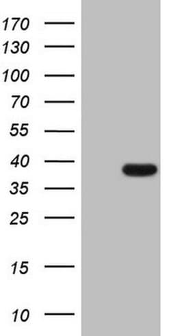 THTPA Monoclonal Antibody (OTI2D5), TrueMAB , OriGene:Antibodies:Primary