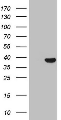 THTPA Monoclonal Antibody (OTI4B5), TrueMAB , OriGene 100 &mu;L; Unconjugated:Antibodies,
