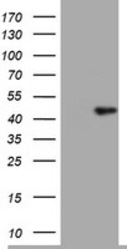 TIA1 Mouse anti-Human, Clone: OTI1C8, lyophilized, TrueMAB 100 μg; Unconjugated:Antibodies,