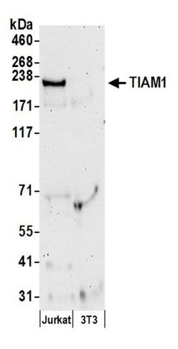 TIAM1 Rabbit anti-Human, Mouse, Polyclonal, Bethyl Laboratories 10 &mu;l;