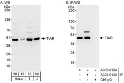 TIAR Rabbit anti-Human, Polyclonal, Bethyl Laboratories 100 &mu;L; Unconjugated:Antibodies,