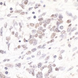 TIF1 Alpha/TRIM24 Rabbit anti-Human, Mouse, Polyclonal, Bethyl Laboratories