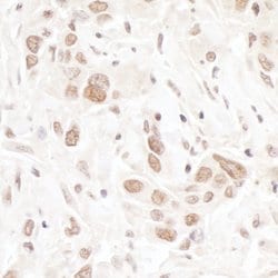 TIF1 Alpha/TRIM24 Rabbit anti-Human, Mouse, Polyclonal, Bethyl Laboratories