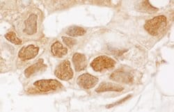 TIGAR Rabbit anti-Human, Polyclonal, Bethyl Laboratories 10 &mu;L; Unconjugated:Antibodies,