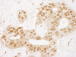 TIGAR Polyclonal Antibody, Bethyl Laboratories 10 &mu;L; Unconjugated:Antibodies,