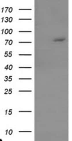 TIGD1 Mouse anti-Human, Clone: OTI5B12, lyophilized, TrueMAB 100 &mu;g;