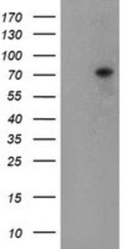TIGD1 Mouse anti-Human, Clone: OTI4G9, lyophilized, TrueMAB 100 &mu;g;