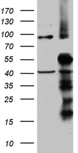 TIMM50 Monoclonal Antibody (OTI1E9), TrueMAB , OriGene:Antibodies:Primary