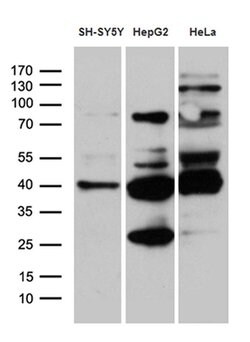 TIMM50 Monoclonal Antibody (OTI1E9), TrueMAB , OriGene 100 &mu;L; Unconjugated:Antibodies,