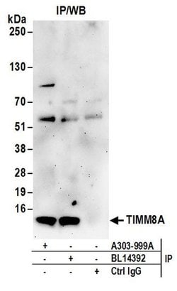 TIMM8A Rabbit anti-Human, Polyclonal, Bethyl Laboratories 100 &mu;L; Unconjugated:Antibodies,