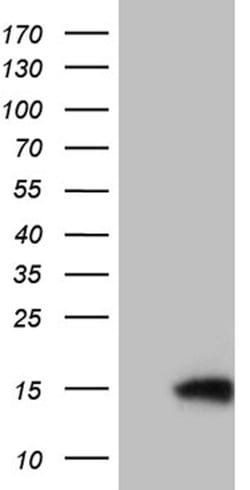 TIMM8A Mouse anti-Human, Clone: OTI5C8, lyophilized, TrueMAB 100 &mu;g;