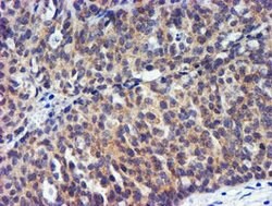 TIMP2 Mouse anti-Human, Clone: OTI2G7, lyophilized, TrueMAB 100 &mu;g;