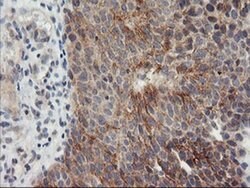 TIMP2 Monoclonal Antibody (OTI2G7), TrueMAB , OriGene:Antibodies:Primary