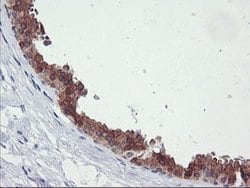TIMP2 Monoclonal Antibody (OTI1D7), TrueMAB , OriGene 100 &mu;L; Unconjugated:Antibodies,