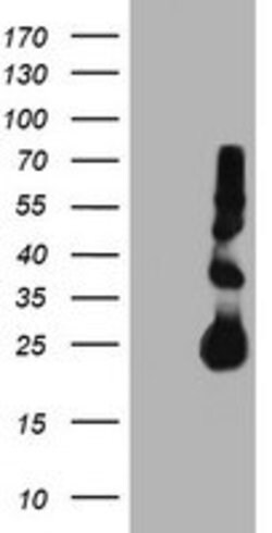 TIMP2 Mouse anti-Human, Clone: OTI2G7, lyophilized, TrueMAB 100 &mu;g;