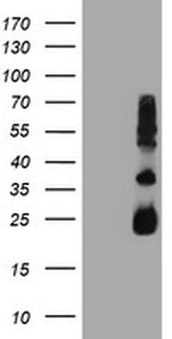 TIMP2 Monoclonal Antibody (OTI3H8), TrueMAB , OriGene 100 &mu;L; Unconjugated:Antibodies,