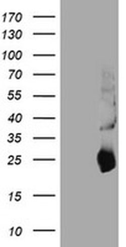 TIMP2 Monoclonal Antibody (OTI1D7), TrueMAB , OriGene 100 &mu;L; Unconjugated:Antibodies,