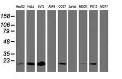 TIMP2 Monoclonal Antibody (OTI1D7), TrueMAB , OriGene 100 &mu;L; Unconjugated:Antibodies,