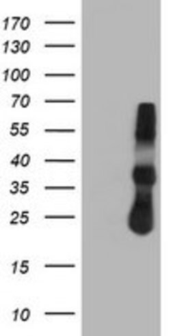 TIMP2 Mouse anti-Human, Clone: OTI1B11, lyophilized, TrueMAB 100 &mu;g;