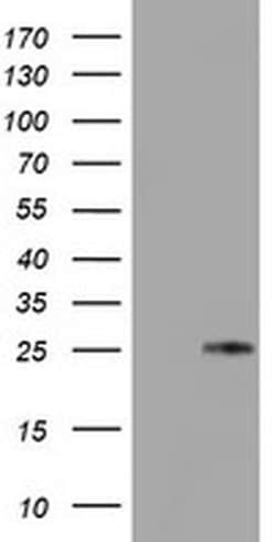 TIMP2 Monoclonal Antibody (OTI3G7), TrueMAB , OriGene:Antibodies:Primary