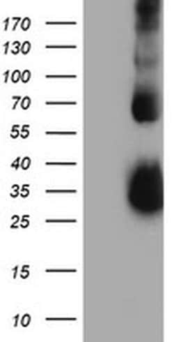 TIMP2 Monoclonal Antibody (OTI1C4), TrueMAB , OriGene 30 &mu;L; Unconjugated:Antibodies,