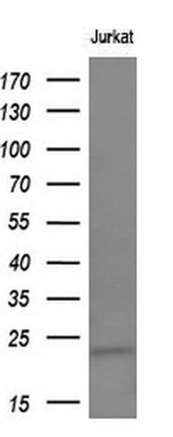 TIMP2 Monoclonal Antibody (OTI1C4), TrueMAB , OriGene 30 &mu;L; Unconjugated:Antibodies,