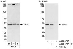 TIPIN Rabbit anti-Human, Polyclonal, Bethyl Laboratories 100 &mu;L; Unconjugated:Antibodies,