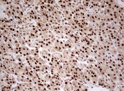 TIPIN Monoclonal Antibody (OTI2E6), TrueMAB , OriGene 100 &mu;L; Unconjugated:Antibodies,