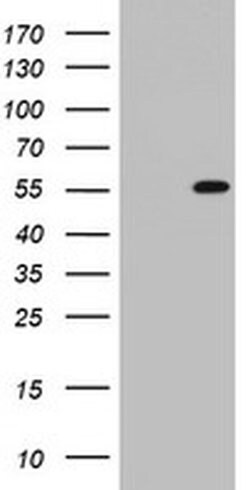 TIPIN Monoclonal Antibody (OTI2E2), TrueMAB , OriGene 30 &mu;L; Unconjugated:Antibodies,
