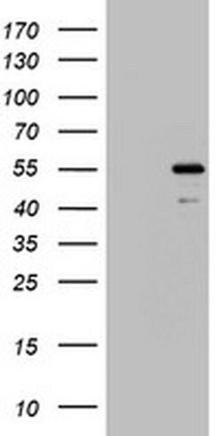 TIPIN Monoclonal Antibody (OTI3A1), TrueMAB , OriGene:Antibodies:Primary