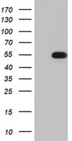 TIPIN Monoclonal Antibody (OTI2E6), TrueMAB , OriGene:Antibodies:Primary