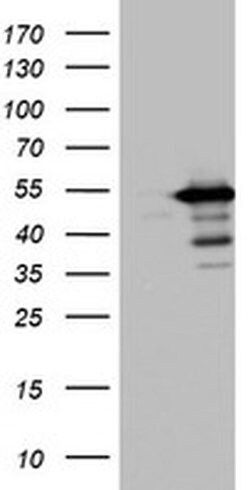 TIPIN Monoclonal Antibody (OTI2C10), TrueMAB , OriGene 100 &mu;L; Unconjugated:Antibodies,