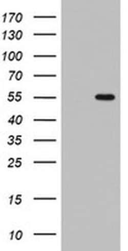 TIPIN Monoclonal Antibody (OTI3B11), TrueMAB , OriGene 100 &mu;L; Unconjugated:Antibodies,