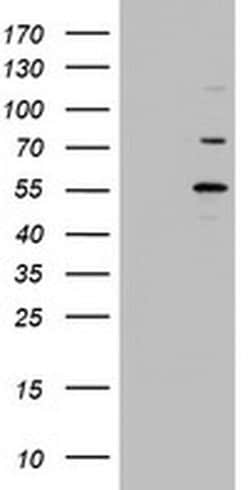 TIPIN Monoclonal Antibody (OTI1A3), TrueMAB , OriGene 100 &mu;L; Unconjugated:Antibodies,