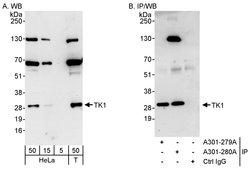 TK1 Rabbit anti-Human, Polyclonal, Bethyl Laboratories 100 &mu;L; Unconjugated:Antibodies,