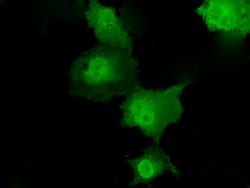 TKT Mouse anti-Human, Clone: OTI5H3, lyophilized, TrueMAB 100 &mu;g; Unconjugated:Antibodies,