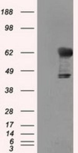 TKT Mouse anti-Human, Clone: OTI5H3, lyophilized, TrueMAB 100 &mu;g; Unconjugated:Antibodies,