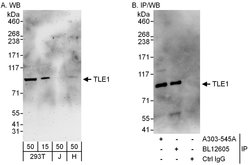 TLE1 Rabbit anti-Human, Polyclonal, Bethyl Laboratories 100 &mu;L; Unconjugated:Antibodies,