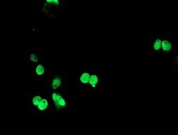 TLE1 Monoclonal Antibody (OTI2D8), TrueMAB , OriGene 100 &mu;L; Unconjugated:Antibodies,