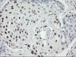 TLE1 Monoclonal Antibody (OTI1F9), TrueMAB , OriGene 100 &mu;L; Unconjugated:Antibodies,