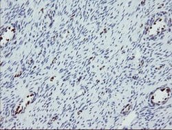 TLE1 Monoclonal Antibody (OTI1F9), TrueMAB , OriGene 100 &mu;L; Unconjugated:Antibodies,