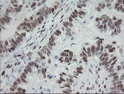 TLE1 Monoclonal Antibody (OTI1F9), TrueMAB , OriGene 100 &mu;L; Unconjugated:Antibodies,