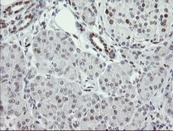 TLE1 Monoclonal Antibody (OTI1F9), TrueMAB , OriGene 100 &mu;L; Unconjugated:Antibodies,