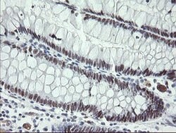 TLE1 Monoclonal Antibody (OTI1F9), TrueMAB , OriGene 100 &mu;L; Unconjugated:Antibodies,