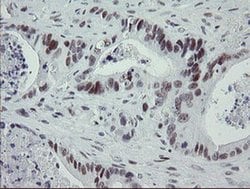 TLE1 Monoclonal Antibody (OTI1F9), TrueMAB , OriGene 100 &mu;L; Unconjugated:Antibodies,